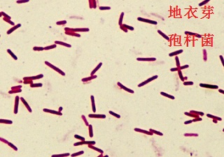 地衣芽孢杆菌