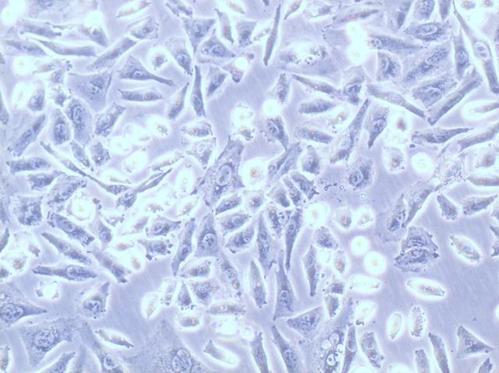 小鼠肾上腺皮质瘤细胞