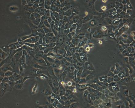 NG108-15 [108CC15]小鼠神经细胞瘤与大鼠神经胶质瘤之融合细胞