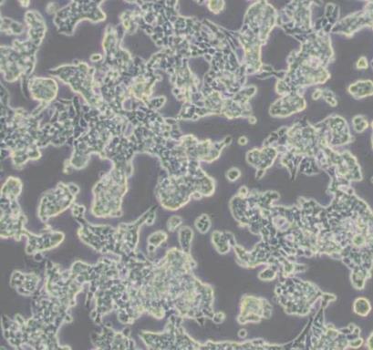 RL95-2 人子宫内膜癌细胞的应用