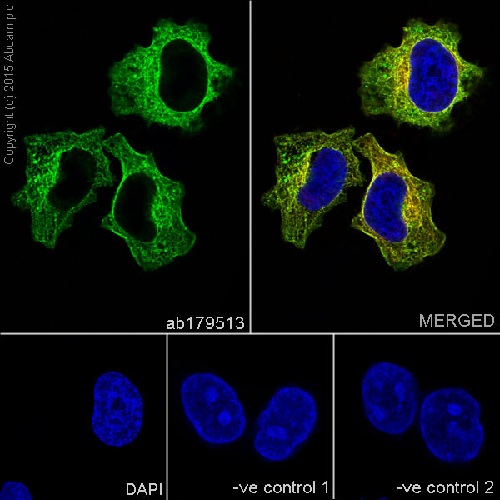 β微管蛋白兔单克隆抗体