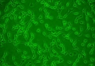 6T-CEM/人T细胞白血病细胞