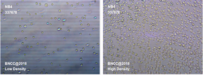 NB4(NB-4)人急性早幼粒白血病细胞