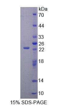 AMPA离子能谷氨酸受体4(GRIA4)重组蛋白