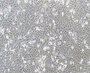 人骨肉瘤细胞；143B
