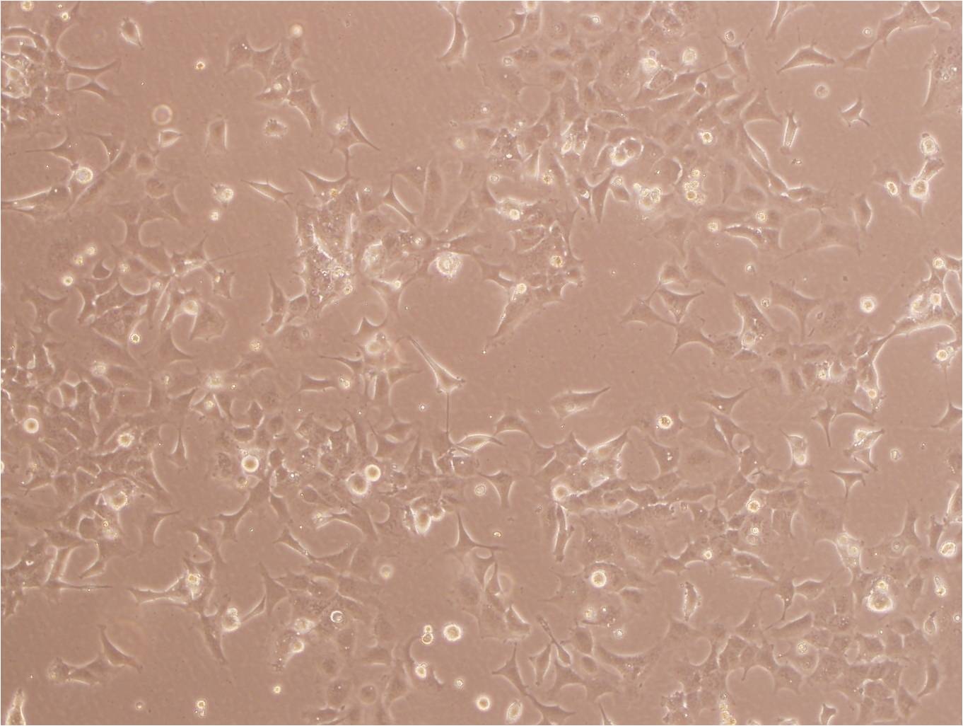 MDA-MB-231 Cell:人乳腺癌细胞系