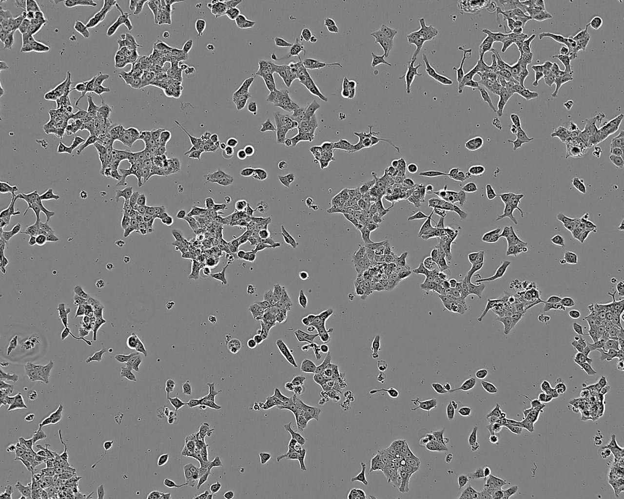 SNU-719 Cell:人胃癌细胞系