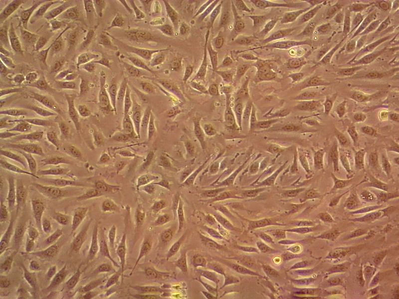 MOVAS-1 fibroblast cells小鼠主动脉平滑肌细胞系