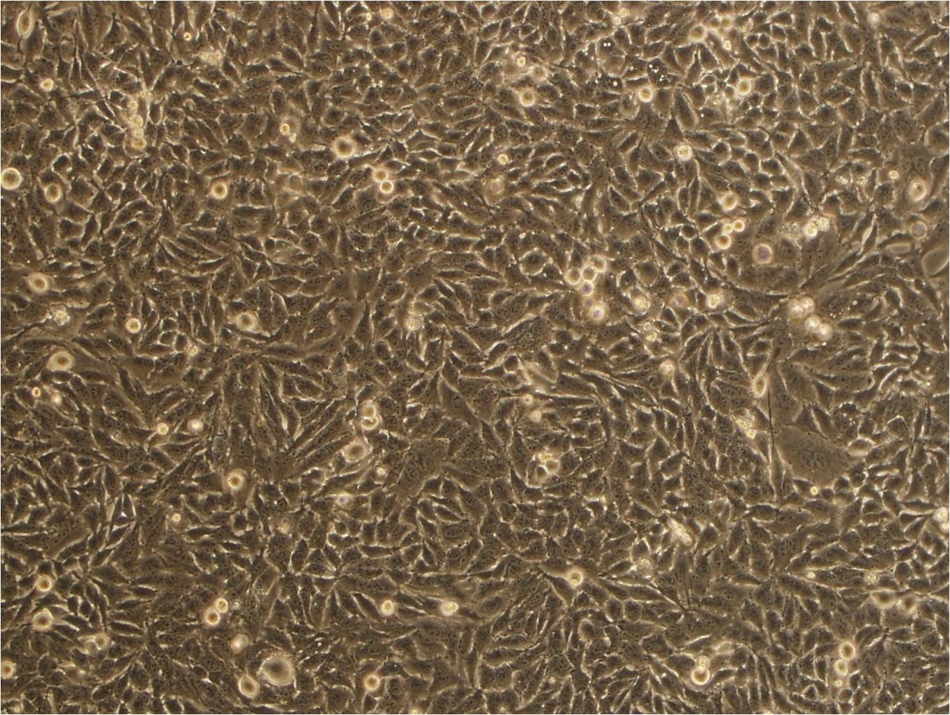 MM96L Adherent人黑色素瘤细胞系