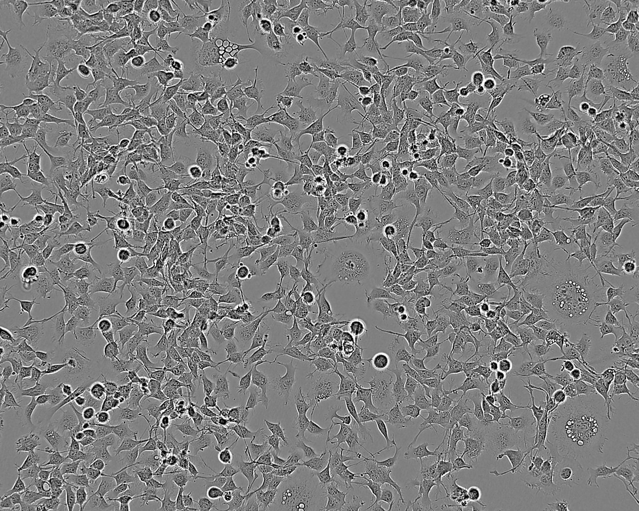 LAPC-4 cell line人前列腺癌细胞系