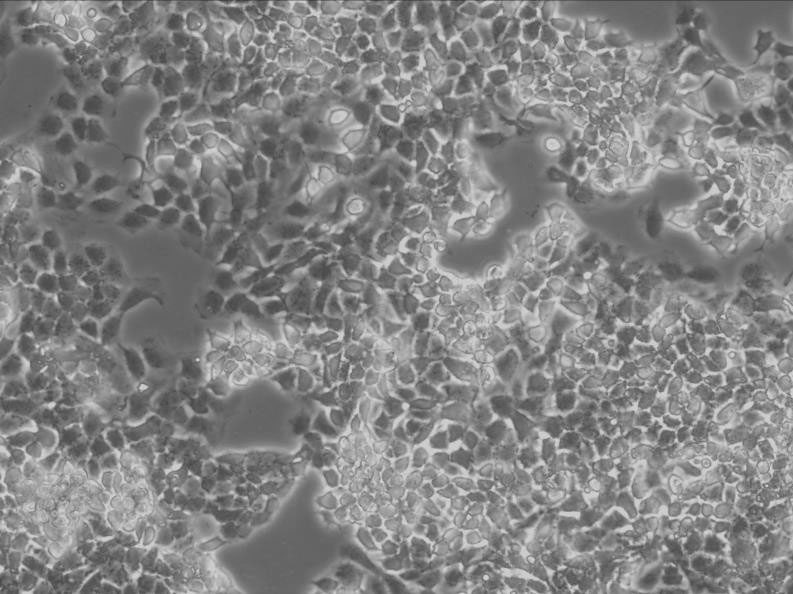JEG-3细胞：人绒毛膜癌细胞系