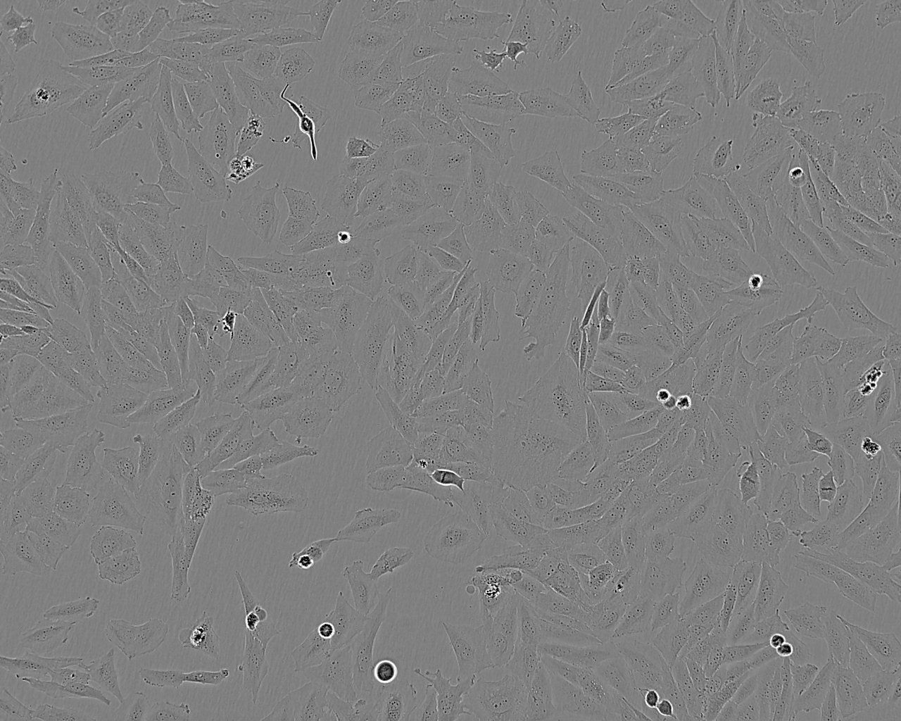 MS1细胞：小鼠胰岛内皮细胞系