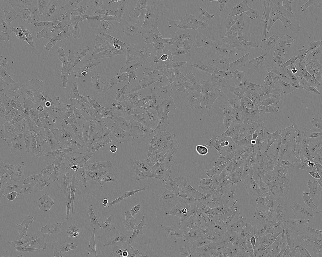 HT-1080 Cells|人纤维肉瘤细胞系