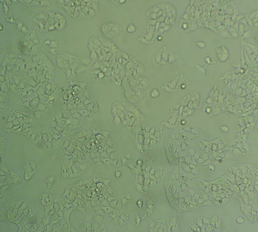 SNU-719 Cell|人胃癌细胞