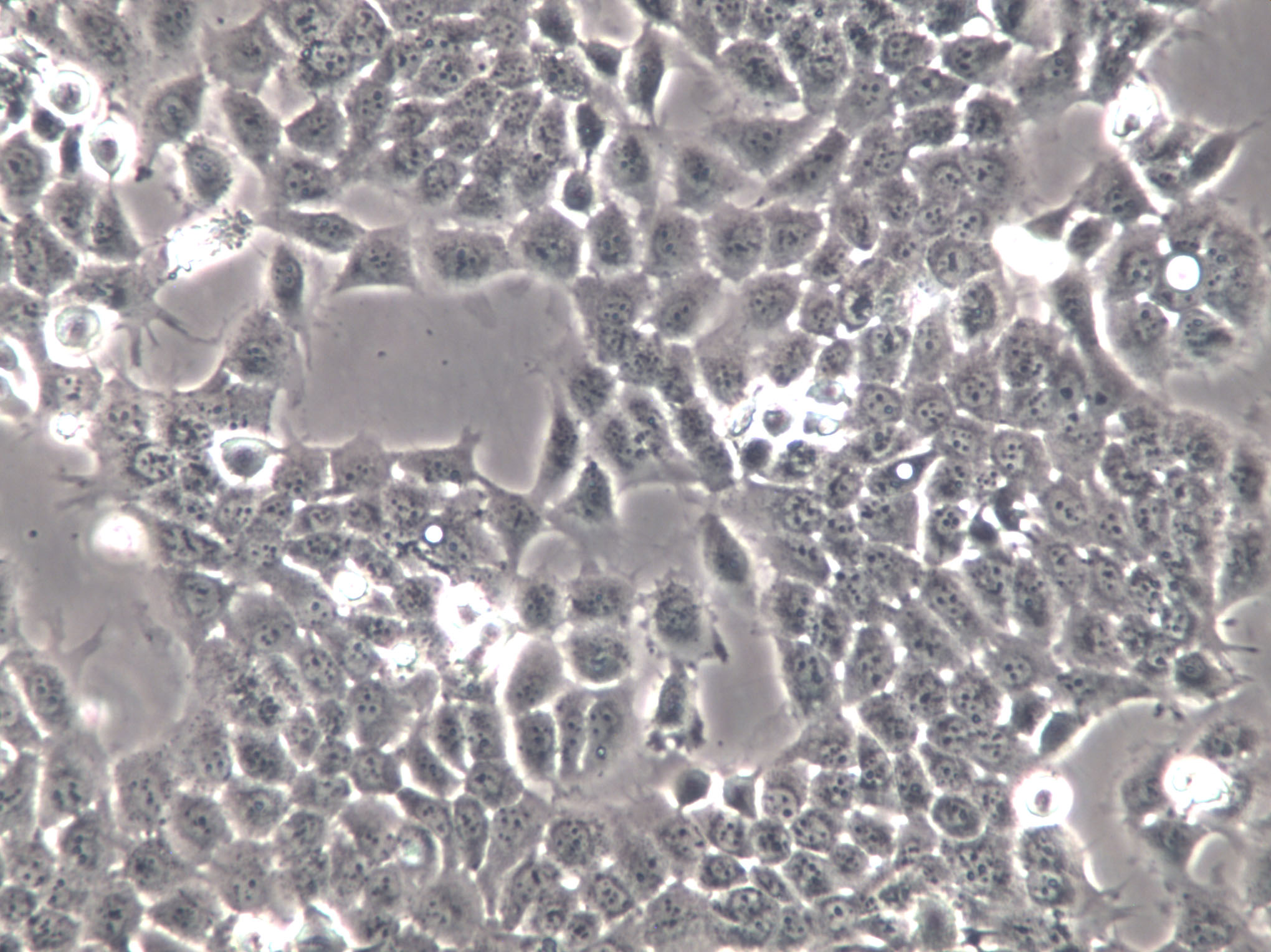 MM96L Cells(赠送Str鉴定报告)|人黑色素瘤细胞