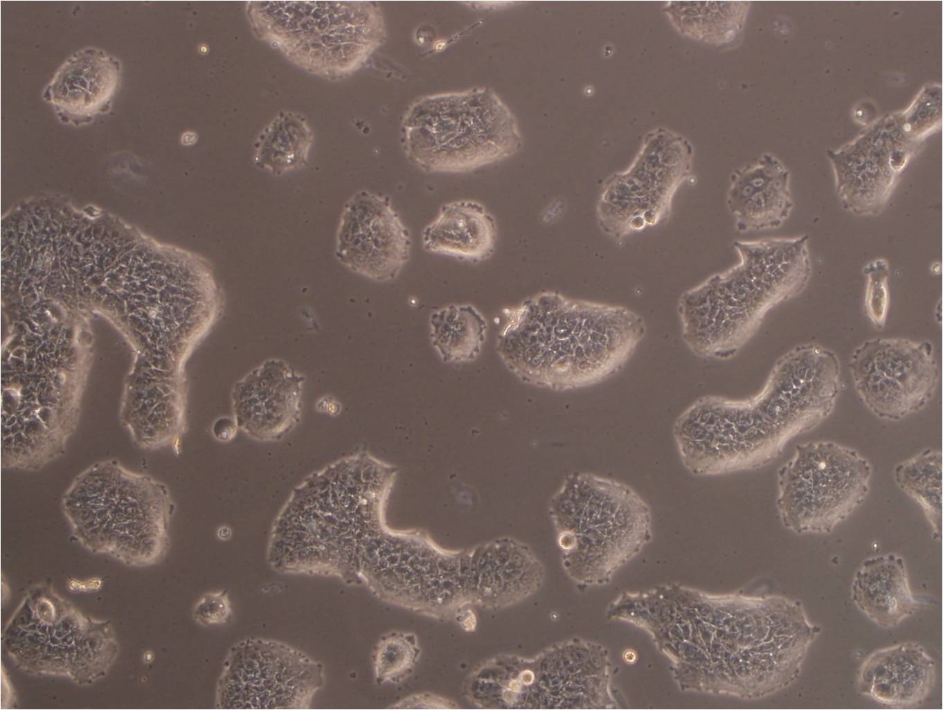 NCI-H2066 Cells|人肺癌可传代细胞系