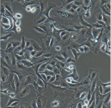 ME-1人类急性髓系白血病细胞
