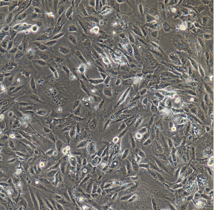 KCL-22人慢性髓系白血病细胞