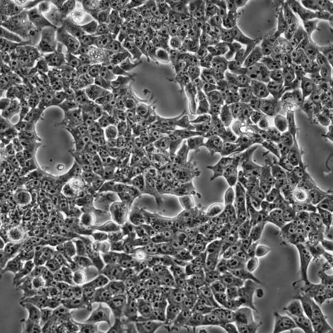 GB-1人脑胶质母细胞瘤
