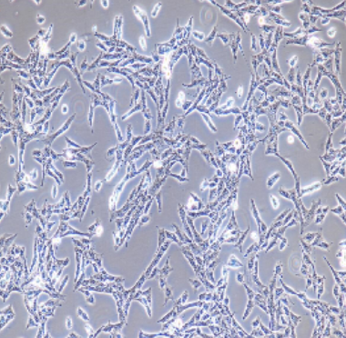 GB-1人脑胶质母细胞