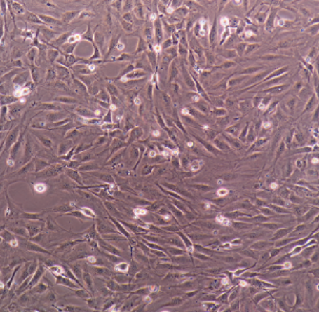 IMR-32人神经母细胞瘤细胞