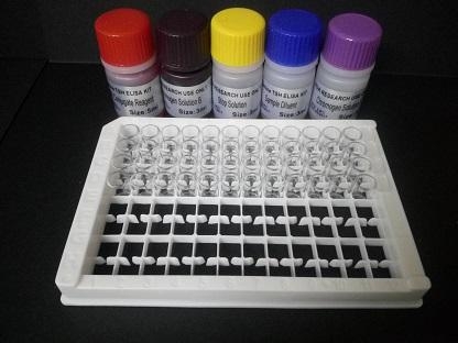 小鼠抗核膜糖蛋白210抗体(gp210)Elisa试剂盒