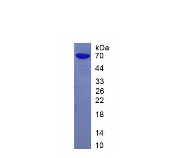 δ样蛋白4(dLL4)重组蛋白