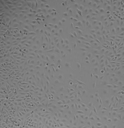 人胶质瘤组织源细胞