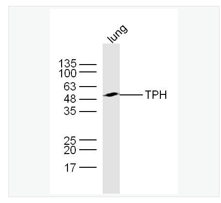 Anti-TPH antibody  -色氨酸羟化酶抗体