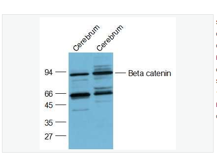 Anti-Beta catenin antibody  -β-连环蛋白/β-连环素/β链接素抗体