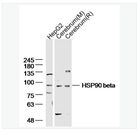 Anti-HSP90 beta antibody-热休克蛋白90β/HSP90 β 抗体