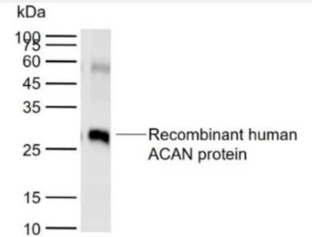 Anti-ACAN antibody -软骨蛋白聚糖抗体