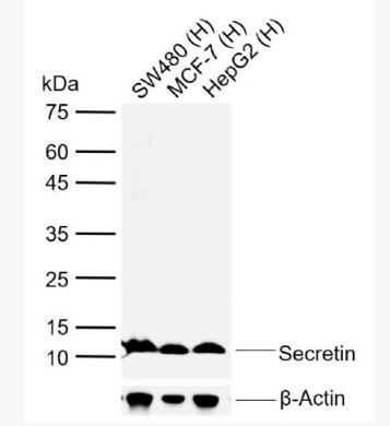 Anti-Secretin antibody-分泌素抗体