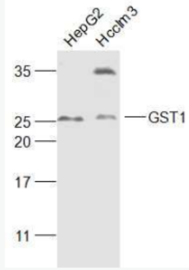 Anti-GST1 antibody-谷胱甘肽转移酶抗体