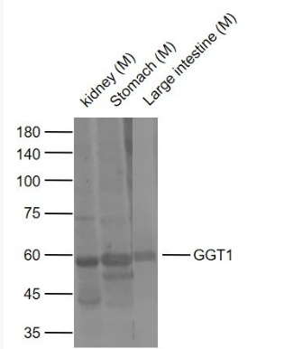 Anti-GGT1 antibody-γ谷氨酰转移酶抗体