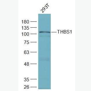 Anti-THBS1 antibody-体超家族成员14抗体