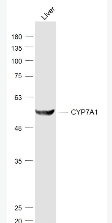 Anti-CYP7A1 antibody-细胞色素P450 7A1抗体/胆固醇7a羟化酶抗体