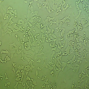 U-138 MG人脑星形胶质母细胞瘤细胞