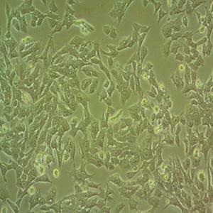 22RV1人细胞