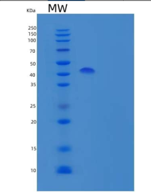 Recombinant Human Serine Protease Inhibitor-clade B9 Protein