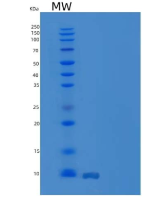 Recombinant Human IL-8 / CXCL8 Protein (aa 28-99)