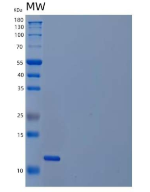 Recombinant Human Platelet-Derived Growth Factor BB/PDGF-BB Protein