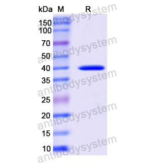 Recombinant Human HSP40/DNAJB1, N-His